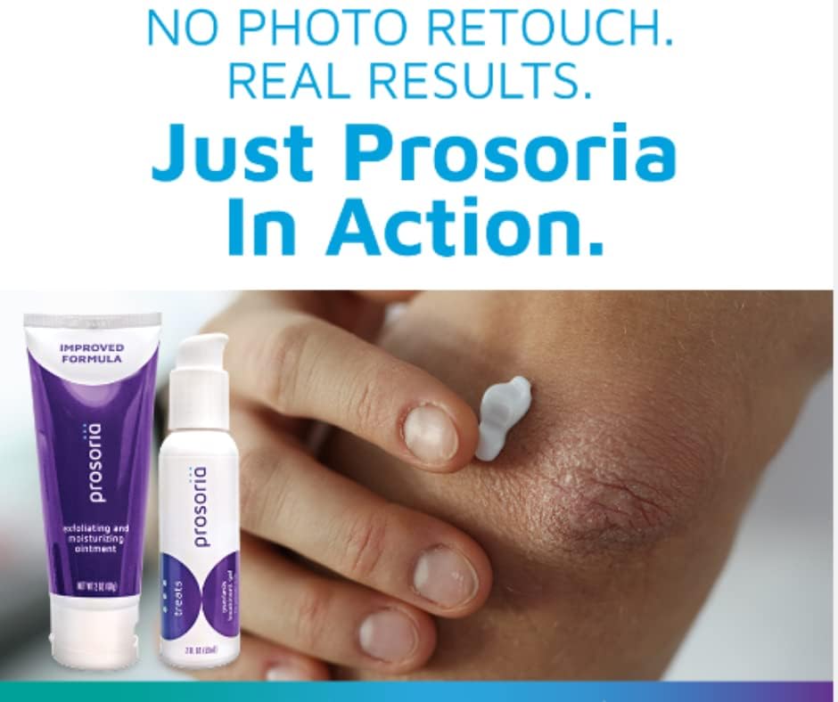 Prosoria Treatment System Single Kit, 2oz