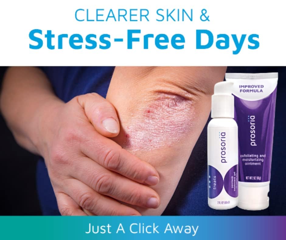 Prosoria Treatment System Single Kit, 2oz