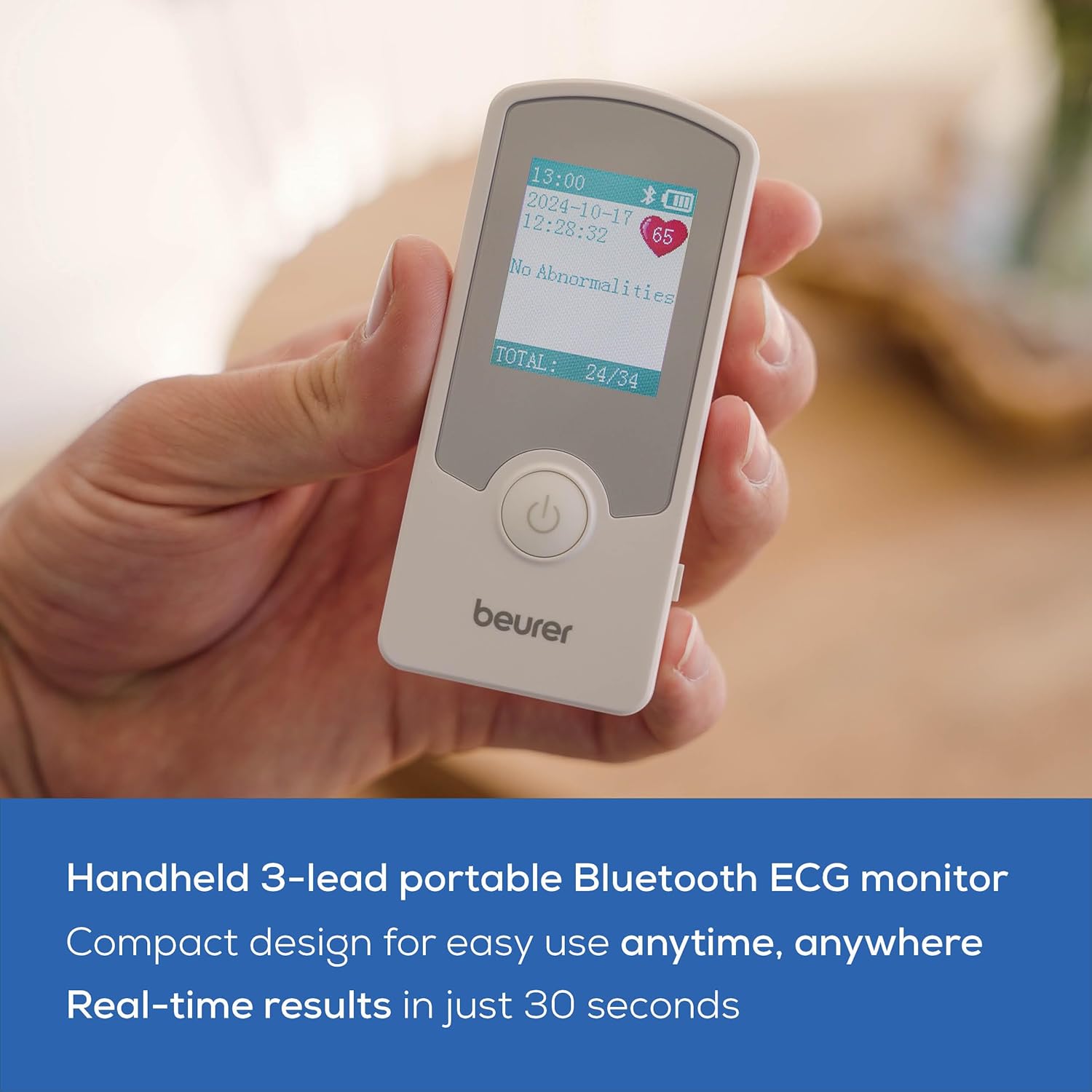 Beurer Cardio Companion EKG Monitor - 3-Lead Portable ECG Machine